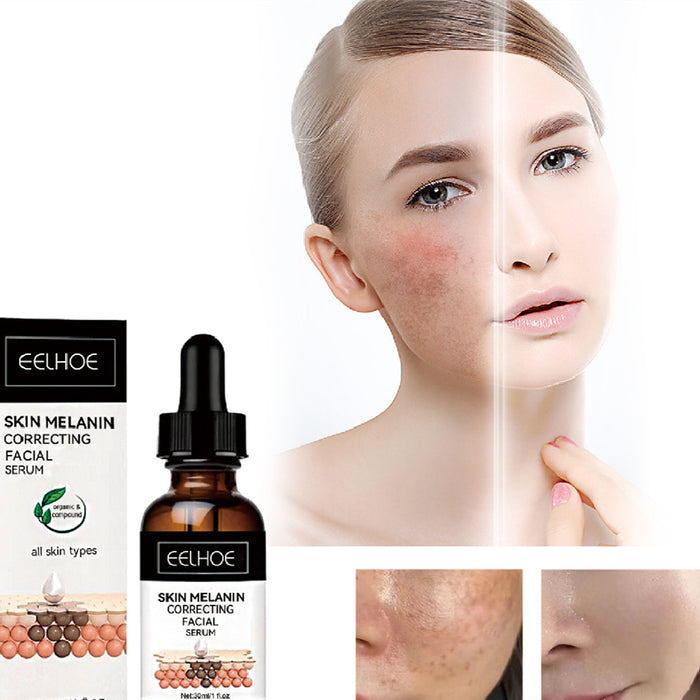 Melanin Repair Facial Essence 30ml | Whitening & Hydrating Serum with Retinol, Vitamin C & Niacinamide